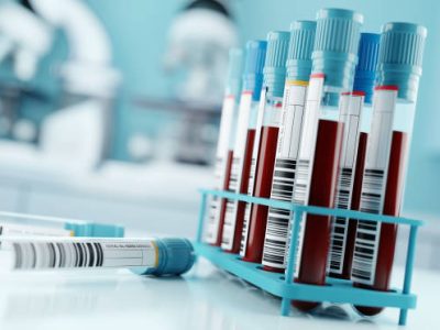 Blood samples and test results in a clinical medical laboratory. 3D illustration